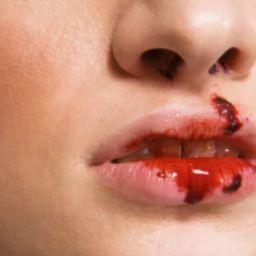 High School Girl Hospitalized After Boy on All-Girls Field Hockey Team Causes Severe Injury
